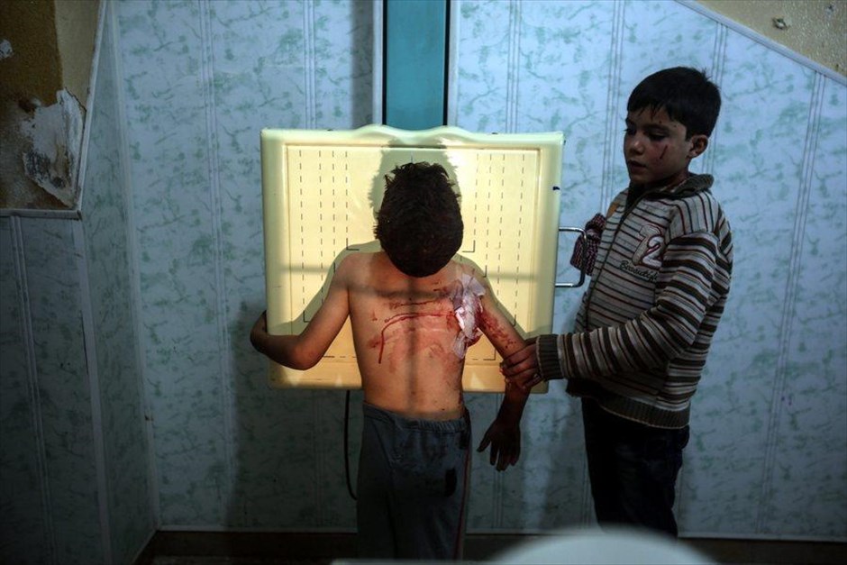 Συρία: Αεροπορικοί βομβαρδισμοί στη Ντούμα. Παιδιά που τραυματίστηκαν σε αεροπορικό βομβαρδισμό των δυνάμεων του συριακού καθεστώτος, περιμένουν να εξεταστούν από γιατρό σε ένα νοσοκομείο, στην ελεγχόμενη από τους αντάρτες πόλη Ντούμα. Σύμφωνα με αναφορές διαφόρων εθελοντικών οργανώσεων, από τις αεροπορικές επιδρομές πολλά σπίτια κάηκαν και πάνω από 25 άνθρωποι τραυματίστηκαν.