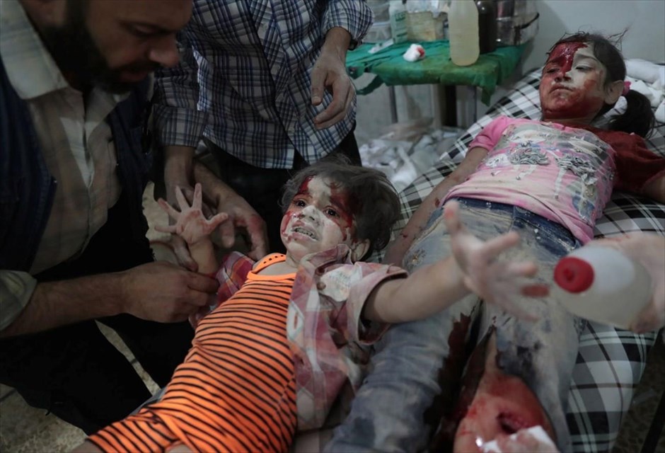 World Press Photo Awards 2017 - Spot News, Singles - 2. Δεύτερο βραβείο στην κατηγορία «Spot News, Singles» για τον Abd Doumany που φωτογράφισε δύο παιδιά σε αυτοσχέδιο νοσοκομείο, ύστερα από βομβαρδισμούς στη συνοικία Ντούμα της Δαμασκού, στη Συρία.