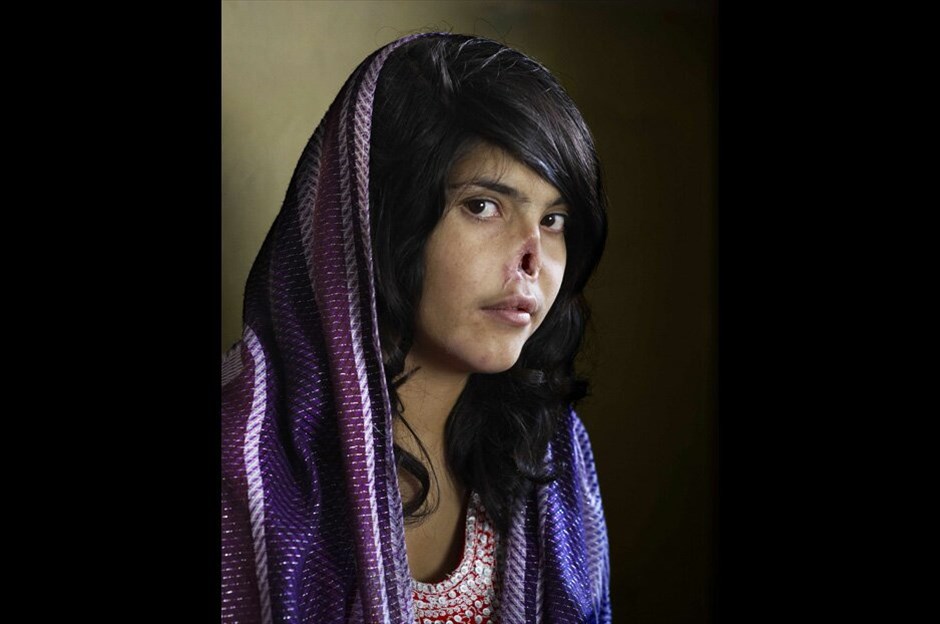 World Press Photo 2010 #1. Η Jodi Bieber, φωτογράφος του περιοδικού Time με έδρα τη Νότια Αφρική, κέρδισε το διαγωνισμό World Press Photo of the Year 2010. Στη φωτογραφία της απεικονίζεται η 18χρονη Bibi Aisha, από την επαρχία Ορουζγκάν του Αφγανιστάν, η οποία επέστρεψε στο πατρικό της εγκαταλείποντας τον άντρα της παραπονούμενη για τη βίαιη συμπεριφορά του. Οι Ταλιμπάν έφτασαν μια νύχτα απαιτώντας η Bibi να παραδοθεί στη δικαιοσύνη. Αφού ο διοικητής των Ταλιμπάν ανακοίνωσε την ετυμηγορία, ο σύζυγος της, της έκοψε τα αυτιά και τη μύτη. Η Bibi εγκαταλείφθηκε αλλά διασώθηκε από προσωπικό εθελοντικών οργανώσεων και τον αμερικανικό στρατό. / Jodi Bieber / Institute for Artist Management for Time Magazine