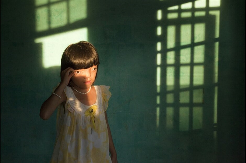 World Press Photo 2010 #10. 2ο βραβείο, κατηγορία Contemporary Issues Single. Η Nguyen Thi Ly, 9 ετών, που πάσχει από αναπηρίες του Πορτοκαλί Παράγοντα, στην Ντα Ναγκ του Βιετνάμ. / Ed Kashi/VII Photo Agency