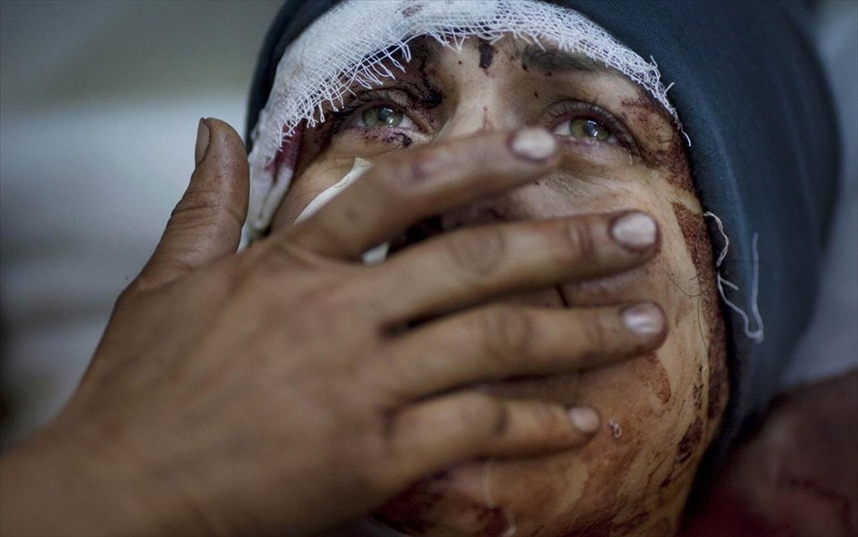 World Press Photo #4. Ο φωτογράφος Rodrigo Abd από την Αργεντινή που εργάζεται στο «Αssociated Press» ήταν ο νικητής της κατηγορίας «General News Single» του διαγωνισμού World Press Photo of the Year 2012. Στη φωτογραφία με ημερομηνία 10 Μαρτίου 2012, απεικονίζεται ένα θύμα του πολέμου στη Συρία, η Αίντα, η οποία κλαίει ενώ αναρρώνει από σοβαρό τραυματισμό όταν το σπίτι της στην επαρχία Ιντλιμπ χτυπήθηκε από τον Ελεύθερο Συριακό Στρατό.