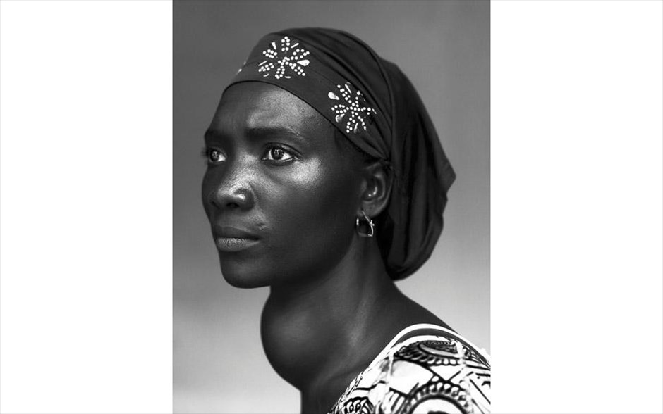 World Press Photo #15. Ο φωτογράφος&nbsp;Stephan Vanfleteren από το Βέλγιο τιμήθηκε με το πρώτο βραβείο στην κατηγορία «People - Staged Portraits Stories», για τη σειρά «Ανθρωποι του ελέους, Γουϊνέα». Η φωτογραφία με ημερομηνία 17 Οκτωβρίου 2012, απεικονίζει την 30χρονη&nbsp;Makone Soumaoro, η οποία έχει βρογχοκήλη.