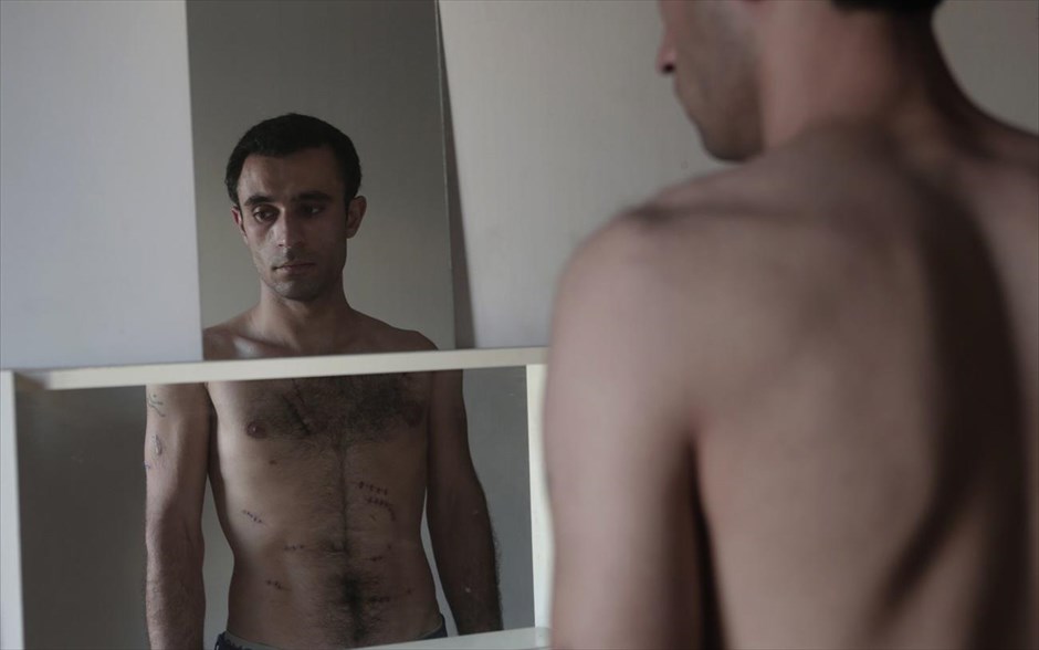 Ιρανός μετανάστης θύμα ξυλοδαρμού και επίθεσης. Ο Ashkan Najafi από το Ιράν αποκαλύπτει τις πληγές που προκλήθηκαν από χτυπήματα με αιχμηρό αντικείμενο έπειτα από επίθεση που δέχτηκε από αγνώστους. Σύμφωνα με την μαρτυρία του Ashkan, στις 7 Αυγούστου όταν επέστρεφε από τη δουλειά του τον πλησίασαν τρεις άντρες γύρω στα 28-30 και τον ρώτησαν από που είναι, όταν απάντησε «από το Ιράν», οι δύο από τους τρεις τον χτύπησαν με μπουνιές και έπειτα ξεκίνησαν να τον χτυπούν με αιχμηρό αντικείμενο. Ο Ashkan δέχθηκε 16 μαχαιριές στο σώμα του.
