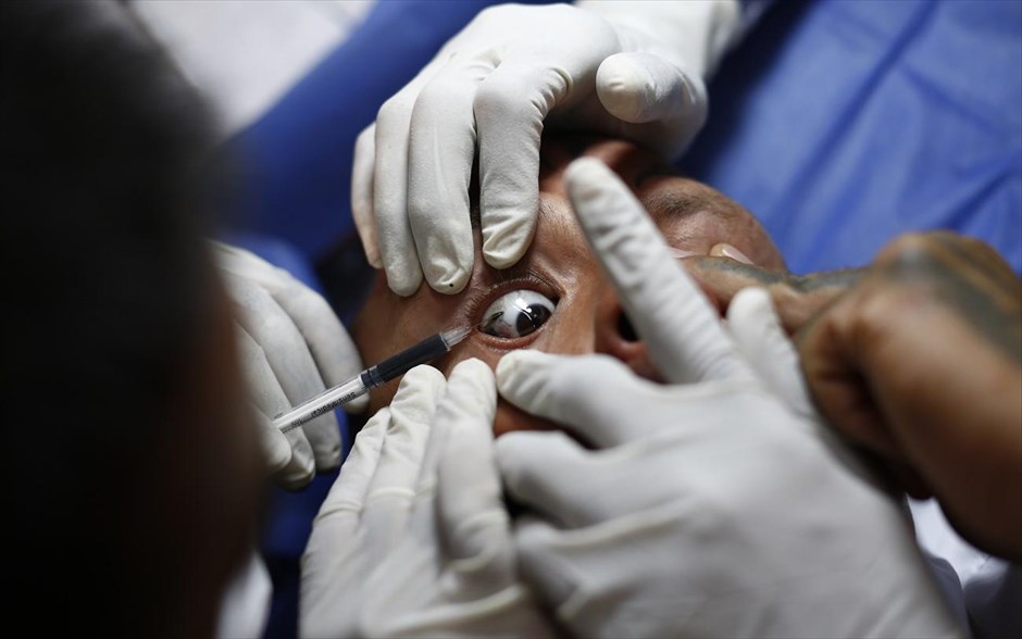 Τατουάζ - Βενεζουέλα. Η κάμερα του Reuters φωτογράφισε αυτόν τον άνδρα να κάνει με τατουάζ το μάτι του μαύρο.