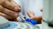 ΚΕΕΛΠΝΟ: Δεν υπάρχει αύξηση κρουσμάτων μηνιγγίτιδας
