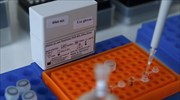 Βραζιλία: Επιβεβαιώθηκε μετάδοση ιού Ζίκα μέσω μετάγγισης αίματος