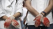 Ένστολη διαμαρτυρία έκαναν νοσηλευτές έξω από τη Βουλή