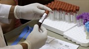 Νότια Κορέα: Επιβεβαιώθηκε το έκτο κρούσμα μόλυνσης από τον ιό Ζίκα