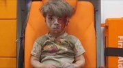 Συρία: Υπέκυψε στα τραύματά του ο αδερφός του μικρού Ομράν