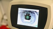 Έρευνα: Το LASIK έχει τα καλύτερα αποτελέσματα διόρθωσης στην όραση