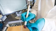 «Στυλό» για χειρουργούς εντοπίζει τον καρκίνο εντός δευτερολέπτων