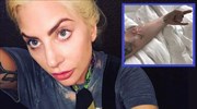Lady Gaga: Εσπευσμένα στο νοσοκομείο η διάσημη τραγουδίστρια