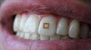Αισθητήρας στα δόντια για παρακολούθηση διατροφής