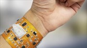 «Έξυπνο» περιβραχιόνιο υπόσχεται επανάσταση στις συσκευές παρακολούθησης υγείας του χρήστη
