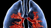 Οι επιστήμονες εντόπισαν πιθανή θεραπεία για την πνευμονική αρτηριακή υπέρταση