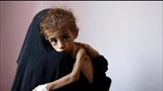 Υεμένη: Για κίνδυνο γενικευμένου λιμού προειδοποιεί ο ΟΗΕ