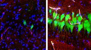 Επιστήμονες του Yale αναβίωσαν την κυτταρική δραστηριότητα μετά θάνατον σε εγκεφάλους χοίρων