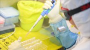 ΗΠΑ: Τα διαγνωστικά τεστ για τον κοροναϊό δεν λειτουργούν σωστά