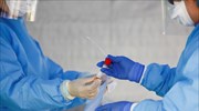 Πράσινο φως στο νέο τεστ αντισωμάτων της Roche