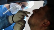 Κύπρος: Εργαστηριακοί έλεγχοι σε εργαζόμενους σε εστίαση, κομμωτήρια, ινστιτούτα αισθητικής