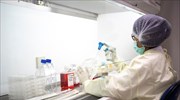 Γαλλία: Ασθενείς με ήπια μορφή της Covid-19 ανέπτυξαν αντισώματα