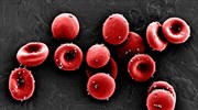 «Νέα γενιά» εμβολίων υπόσχεται τεχνική με νανοσωματίδια σε ερυθρά αιμοσφαίρια