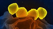 Αντιμικροβιακές μεμβράνες για επιδέσμους που σκοτώνουν βακτήρια