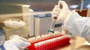 Κορωνοϊός-Ρωσία: Εγκρίθηκε το πρώτο φάρμακο που θα πωλείται με συνταγή