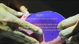 MIPS - Medical Imaging Projection System