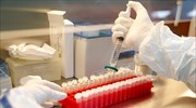 Ιταλία: Η χώρα επιδιώκει να παράγει εγχωρίως εμβόλια mRNA κατά της Covid-19, σύμφωνα με τους FT