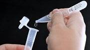 Self-test:  Πότε πρέπει να δηλωθεί το αποτέλεσμα από τους εργαζόμενους στον ιδιωτικό τομέα