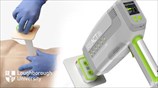 Student designs life-saving device that rapidly stops bleeding from knife wounds