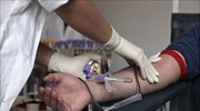 Προς επανεξέταση το έντυπο του ΕΚΑ  που αναφέρει ότι οι ομοφυλόφιλοι δεν μπορούν να γίνουν αιμοδότες
