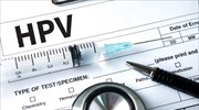 Το εμβόλιο κατά του HPV μειώνει κατά 90% τον κίνδυνο καρκίνου του τραχήλου