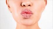 3 σημαντικά πράγματα που ΔΕΝ κάνετε για τα χείλη σας