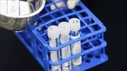 ΙΣΑ: Δεν υπήρξε ποτέ παρέμβαση από τον Σύλλογο για να κρατηθεί ψηλά η τιμή των PCR