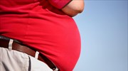 Ισραήλ - Covid-19: Οι παχύσαρκοι που νόσησαν έχουν καλύτερα αντισώματα