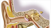 Πετυχημένη χειρουργική επέμβαση σε αυτιά ασθενούς έγινε πριν 5,3 χιλιάδες χρόνια