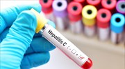 Τέσσερα νέα ύποπτα κρούσματα οξείας ηπατίτιδας σε παιδιά στην Ελλάδα