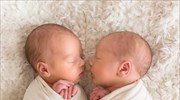 Δίδυμα χωρισμένα στη γέννα: Το «τέλειο πείραμα» που πήγε λάθος
