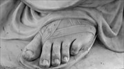 Το περίφημο «ελληνικό πόδι» και η ιατρική του εξήγηση