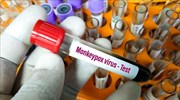 Ευλογιά των πιθήκων: Νέα τεχνική για τη χορήγηση του εμβολίου εγκρίνει ο ΕΜΑ