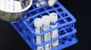 PCR τεστ μπορούν να ανιχνεύσουν έγκαιρα και τον καρκίνο της μήτρας