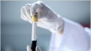 Mπορεί η ομάδα αίματος να επηρεάσει τη γονιμότητα μιας γυναίκας;