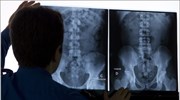Δύο στα τρία κατάγματα φαίνονται στις ακτινογραφίες