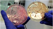 E.coli: Πιο στενή συνεργασία με τη Γερμανία ζητεί η ΕΕ