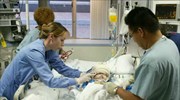 Λος Αντζελες : Γρηγορότερα αναρρώνει το ένα από τα δύο σιαμαία που διαχωρίστηκαν