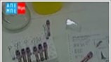 Διακόπτουν τις επί πιστώσει εξετάσεις οι γιατροί του ΟΠΑΔ