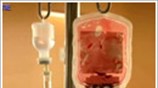 Παγκόσμια ημέρα κατά του AIDS