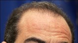 Ο υπουργός Εξωτερικών της Κύπρου Μάρκος Κυπριανού παρίσταται σε συνέντευξη Τύπου του ...